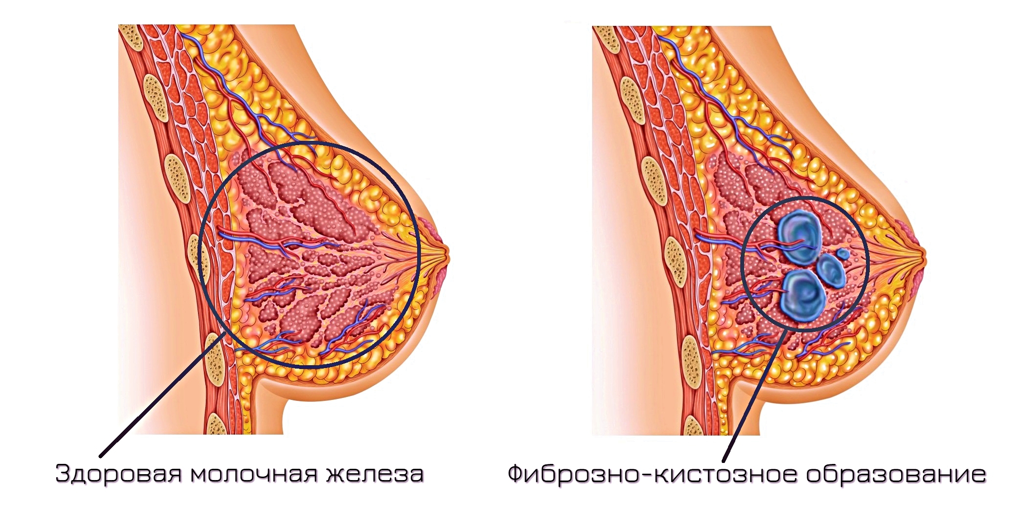 Гинеколог назвала причины, почему болит грудь у женщины — рака среди них нет | DOCTORPITER